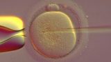 הזרקת זרעון בודד לתוך הביצית -ICSI