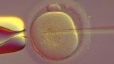 הזרקת זרעון בודד לתוך הביצית -ICSI