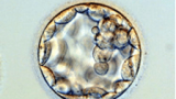 עובר בן 5-6 ימים (בלסטוציסט) המכיל כ 100 תאים